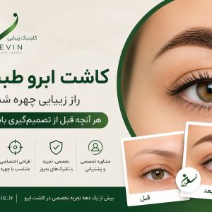 کاشت ابرو طبیعی؛ راز زیبایی چهره و آنچه قبل از تصمیم‌گیری باید بدانید
