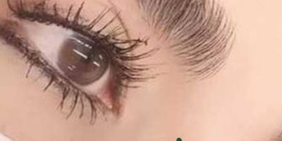 راجع به مراقبتهای قبل از کاشت چه میدانید؟